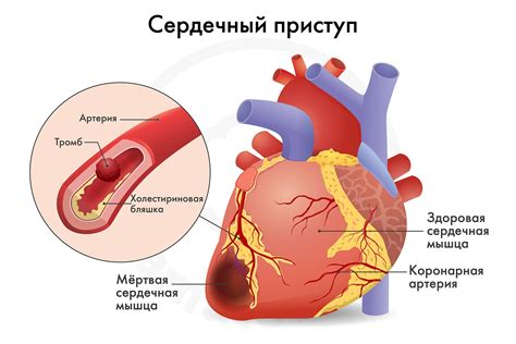 Нестабильный сердечный ритм: причины и симптомы