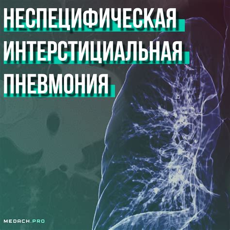 Нестационарная пневмония