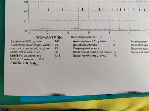 Нестрессовый тест положительный при КТГ