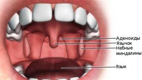 Обзор аденоидов: особенности и возможные проблемы у детей