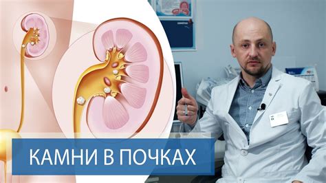 Образование кальциевых отложений в почках у домашних питомцев: причины и симптомы