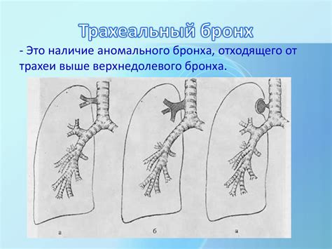 Ожирение и его связь с уменьшением объема легких