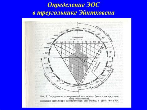 Определение ключевых точек в треугольнике Эйнтховена: базовые подходы и методология