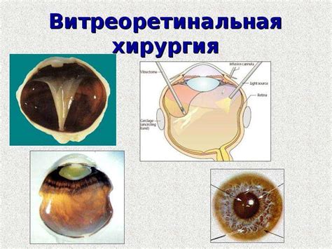 Определение офтальмологии как науки и медицинской специальности