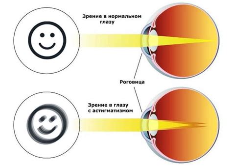 Ослепление и утрата зрения: потенциальные последствия