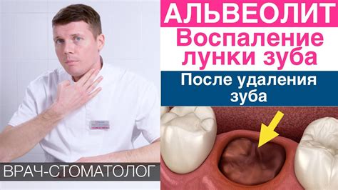 Осложнения после операций: потенциальное воспаление внутреннего лидка