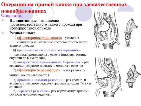 Основные методы изучения структур и функций малого таза