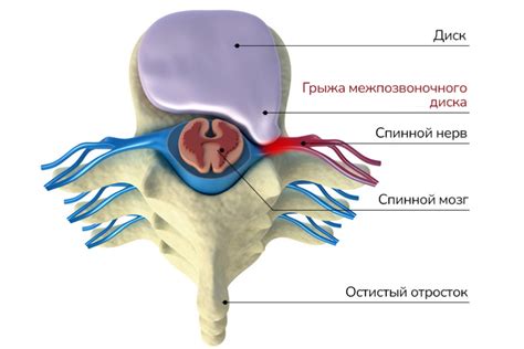 Основные подходы к терапии хронической неприятности в области шейного отдела у женщин