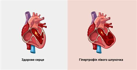 Основные признаки нарушения функционирования левого сердечного желудочка