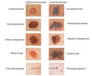 Основные признаки отека после повреждения кожи