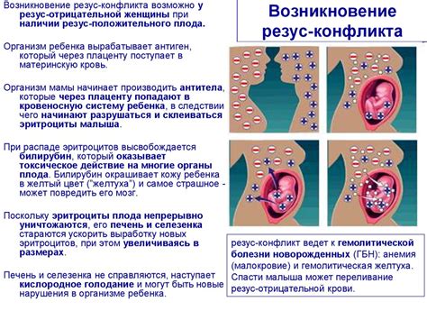 Основные причины возникновения резус-конфликта: источники проблемы