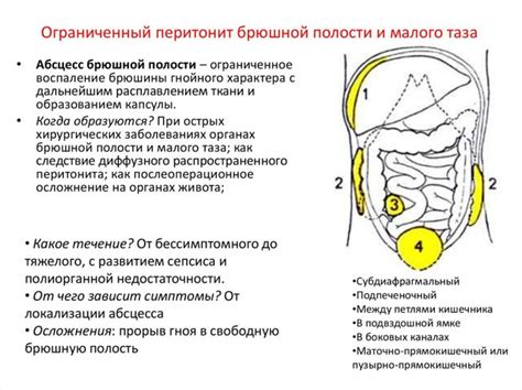 Основные проявления проблемы в малом тазу: на что следует обратить внимание