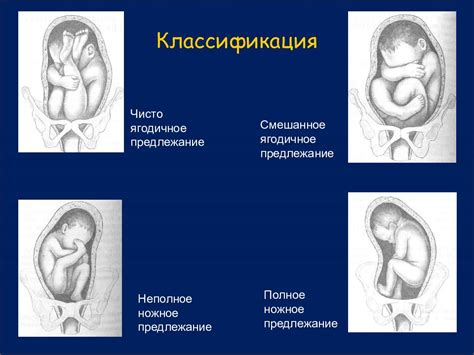 Основные рекомендации для родителей при выявлении абдоминального предлежания у малыша