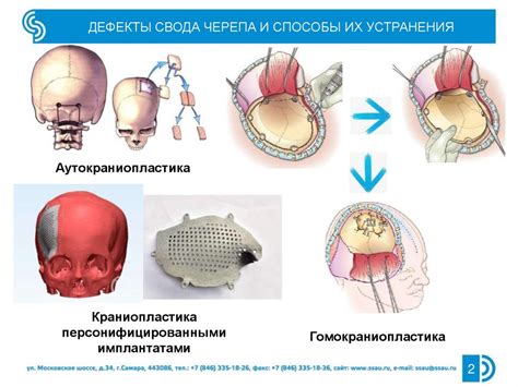 Основные способы очистки сохраненного черепа