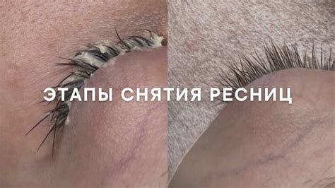 Основные этапы безопасного снятия добавочных ресниц дома