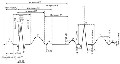 Особенности распознавания сокращения pq на ЭКГ