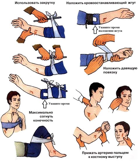 Остановка кровотечения и профилактика инфекции