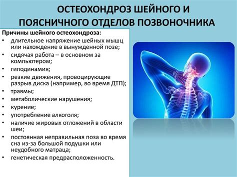 Остеохондроз шейного отдела позвоночника: причины и проявления