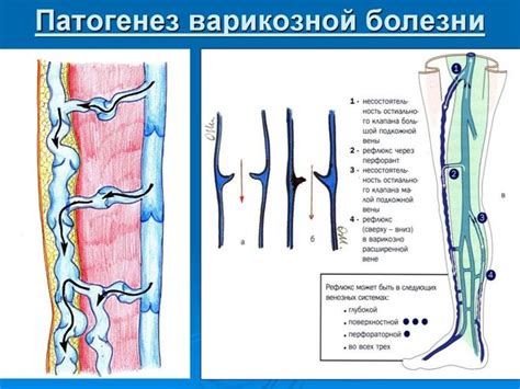 Остиальный клапан и его роль в организме