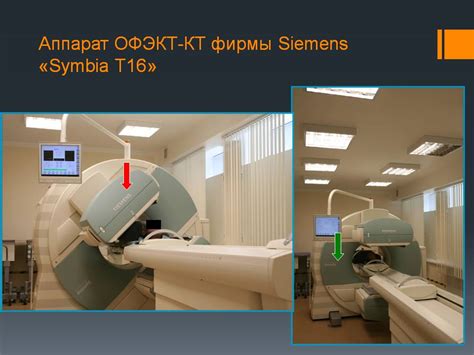 Офэкт кт: особенности в сравнении с пэт кт