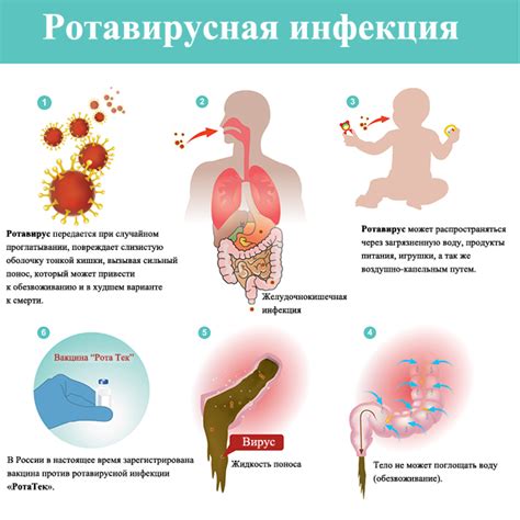 Питание в период ротовирусной инфекции: рекомендации при возникновении диареи