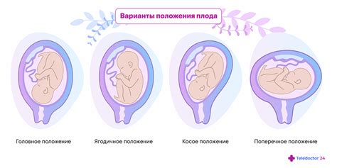 Положение плода на 20 неделе беременности