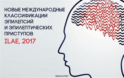 Понимание эпилептических приступов: ключевые концепции и систематизация