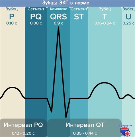 Понятие уменьшенного pq на ЭКГ: объяснение и описание