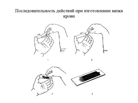 Последовательность действий при изготовлении резинковых брекетов