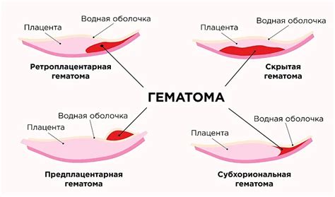 Потенциальные заболевания, сопровождаемые эпизодическим появлением кровянистых выделений