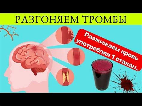 Правильное питание для поддержания свертываемости крови