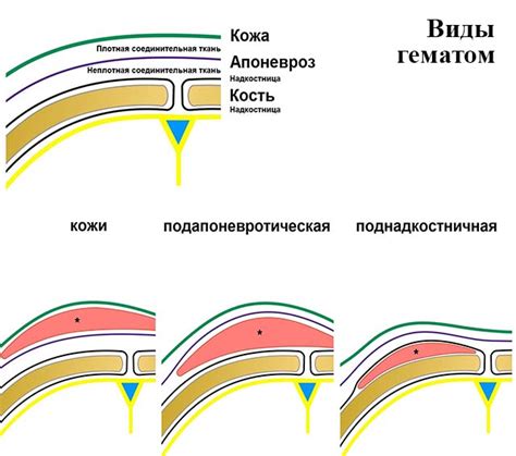 Практические рекомендации для способствующего заживлению ушиба на лбу ребенка