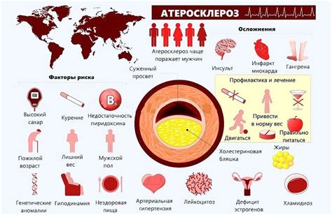 Предупреждение заболеваний кровеносных сосудов на нижних конечностях: рекомендации и советы