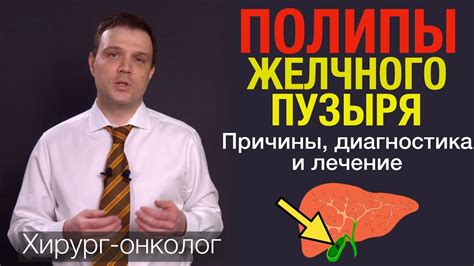 Признаки и симптомы возникновения критического состояния желчного пузыря