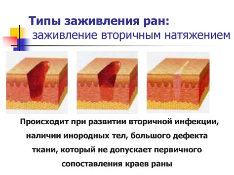 Признаки неправильной заживления раны