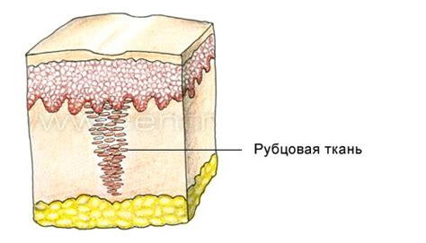 Природные способы ускорения заживления ран и формирования рубца