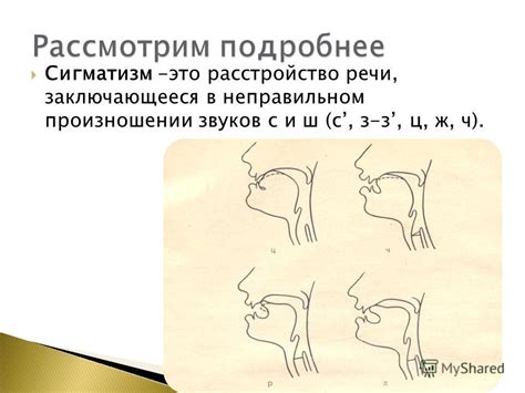 Причины возникновения губно-носовой складки и ее воздействие на внешний облик