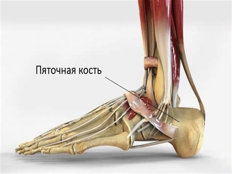 Причины возникновения зонтичной каллозы на пяточной кости стопы