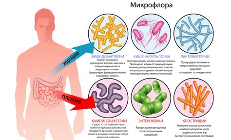 Причины дисбактериоза в прямой кишке: почему нарушается микрофлора?