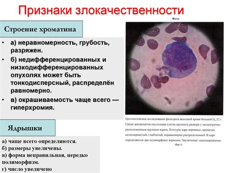 Причины и диагностика неблагоприятных результатов цитологического анализа у женщин