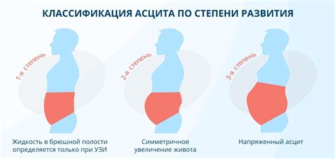 Причины и основные проблемы возникновения складок на брюшной области: влияние факторов и их влияние на состояние кожи