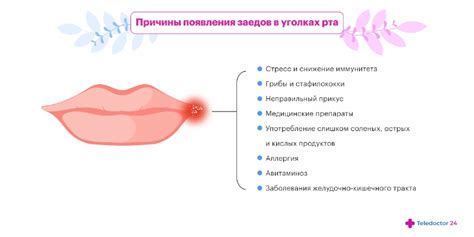 Причины и симптомы появления раздражений в уголках рта