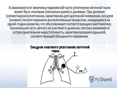 Причины неравномерной пневматизации легочной ткани