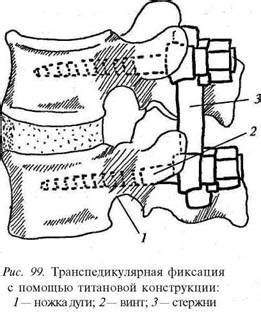 Причины нестабильности сегментов C2-C6