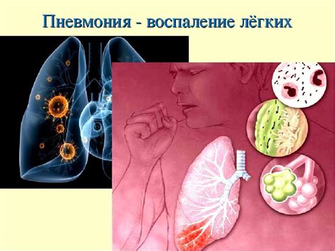 Причины нестационарной пневмонии