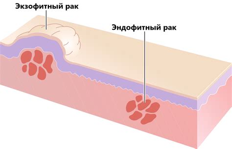 Причины неуточненной локализации опухоли