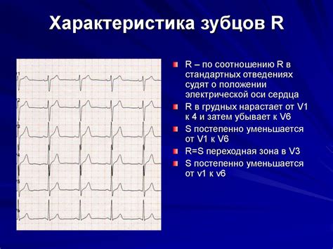 Причины отсутствия зубца Р на ЭКГ