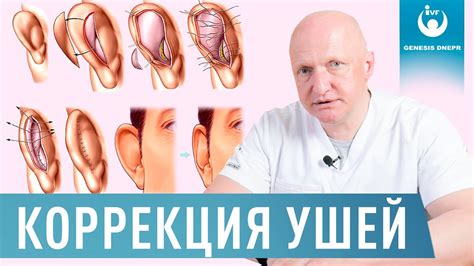 Проблемное положение ушей: диагностика и коррекция