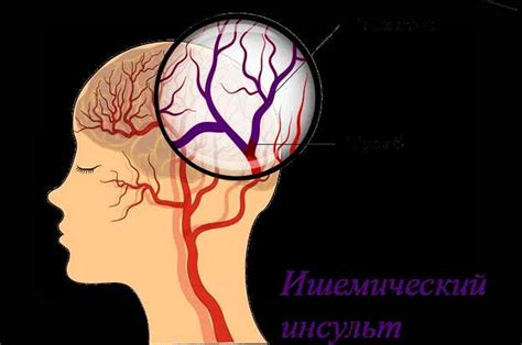 Проблемы с кровообращением: причины и последствия