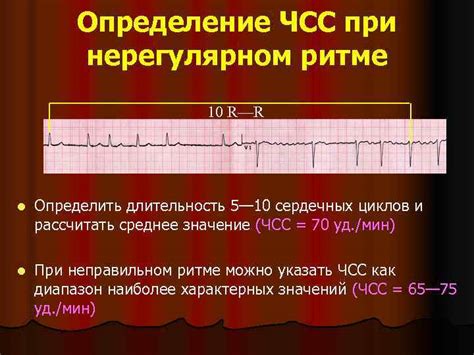 Прогноз и осложнения при нерегулярном наджелудочковом ритме 116